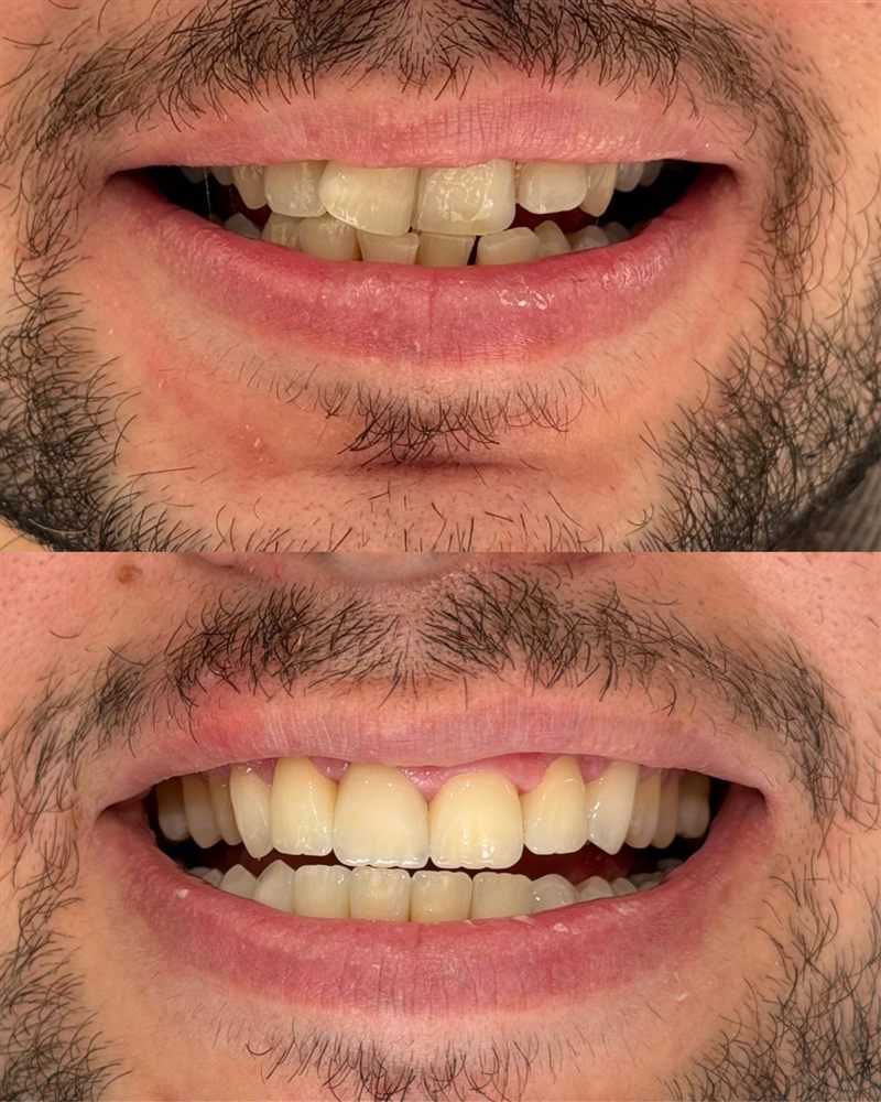 @hndentalklinik Instagram gönderisi 3