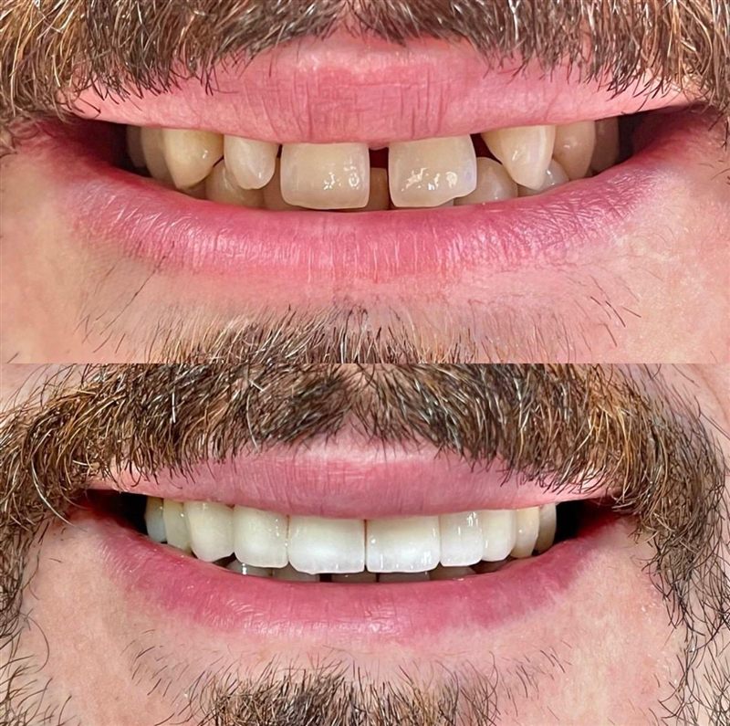 @hndentalklinik Instagram gönderisi 4