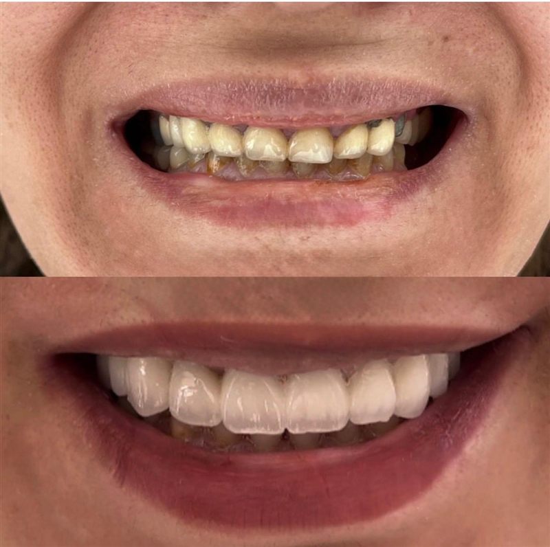 @hndentalklinik Instagram gönderisi 5