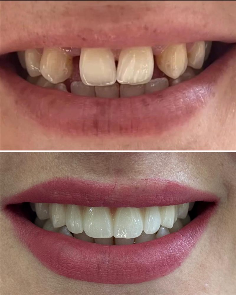 @hndentalklinik Instagram gönderisi 6